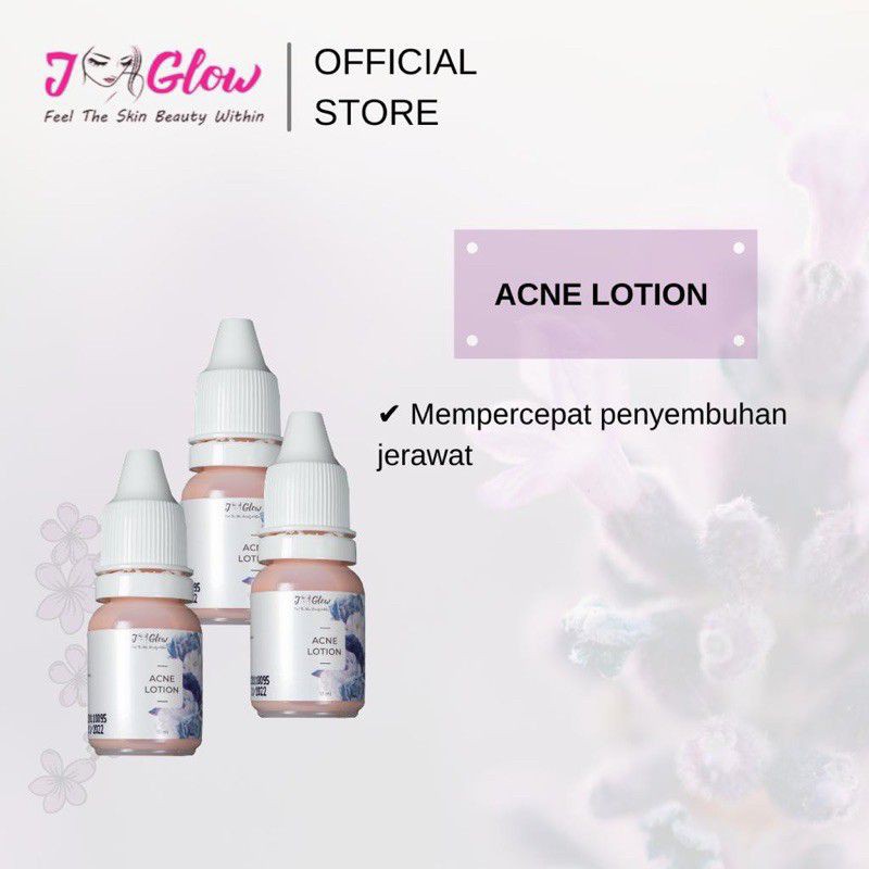 Jual Jglow Skincare Acne Lotion ( SULFUR ) Shopee Indonesia