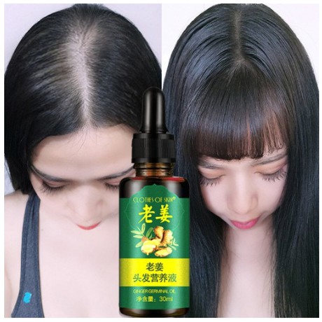 Jual Obat Penumbuh Rambut Serum Rambut Anti Rontok Mengatasi Botak ...