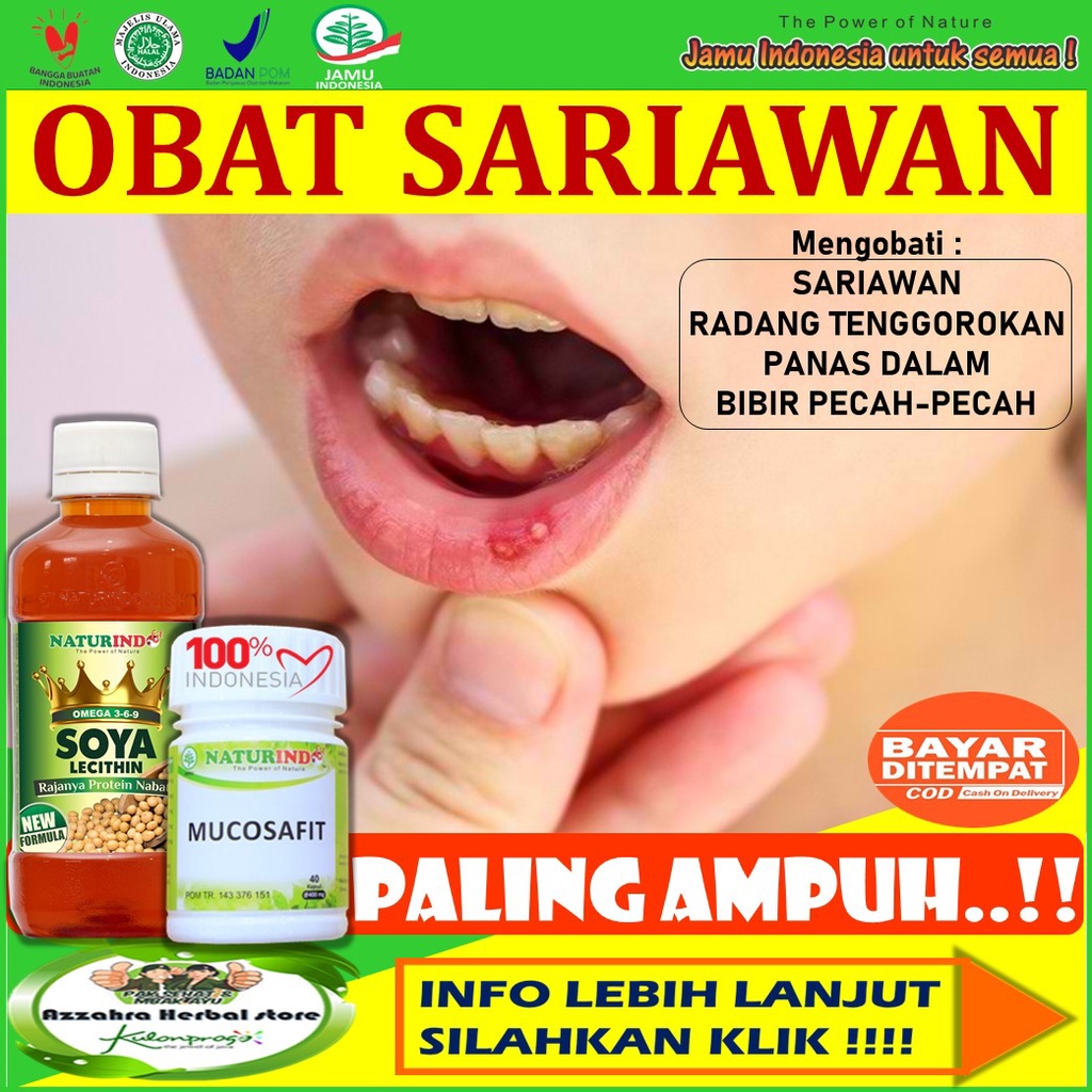 Jual Obat Sariawan Ampuh Obat Sariawan Mulut Bibir Pecah Pecah Dan Kering Radang Tenggorokan