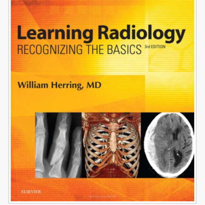 Jual Buku Learning Radiology Recognizing the Basics William Herring Shopee Indonesia