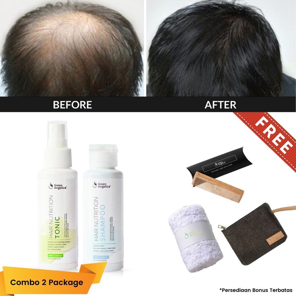 Green Angelica Paket Shampoo + Tonic Penumbuh Rambut Anti Rontok Ketombe BPOM