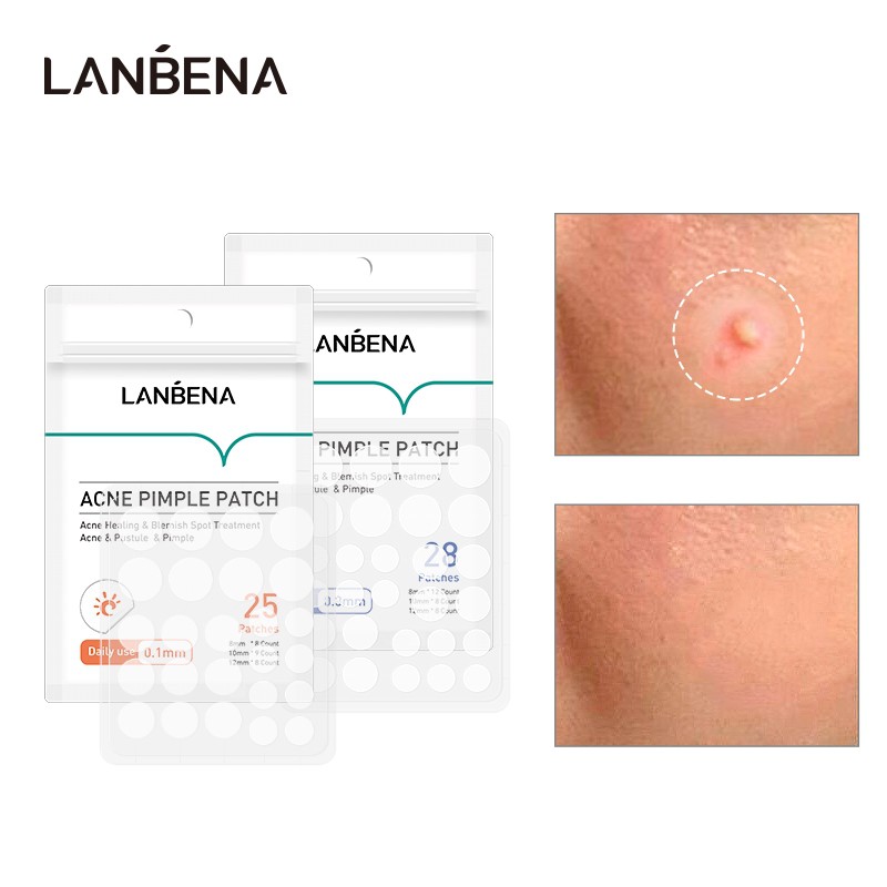 Jual LANBENA Acne Korea Pimple Patch Masker Invisble Stiker Jerawat ...