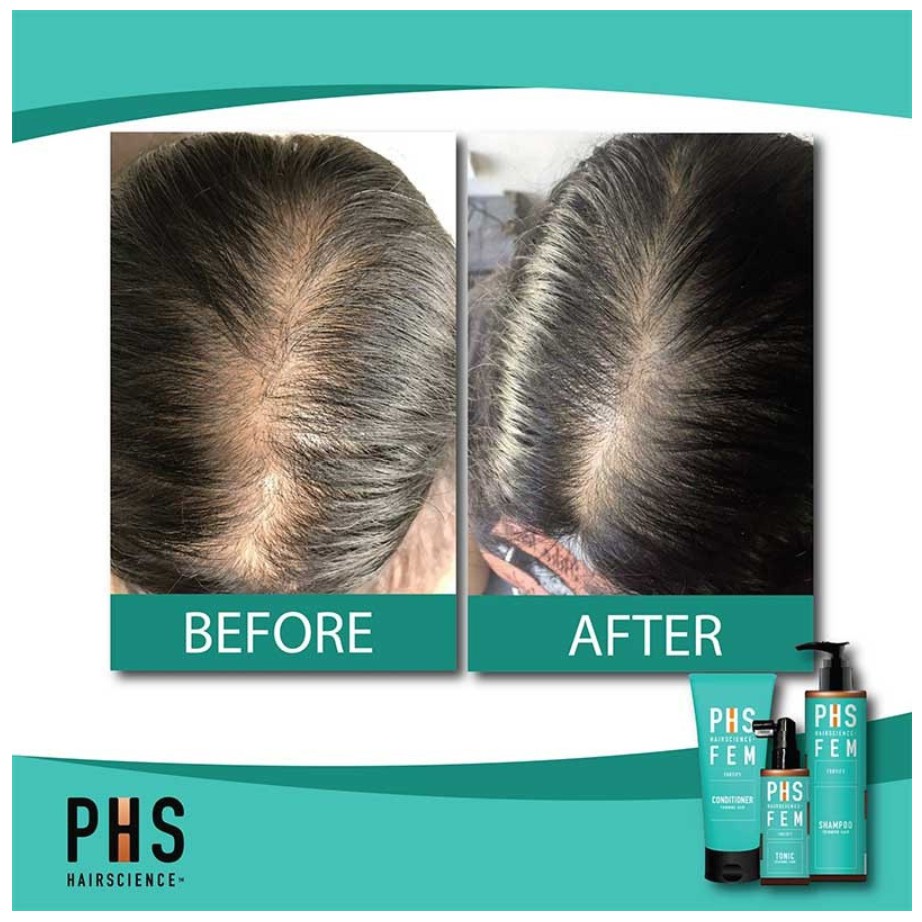 Jual PHS Hairscience FEM Fortify Shampoo For Hair Loss | Shopee Indonesia