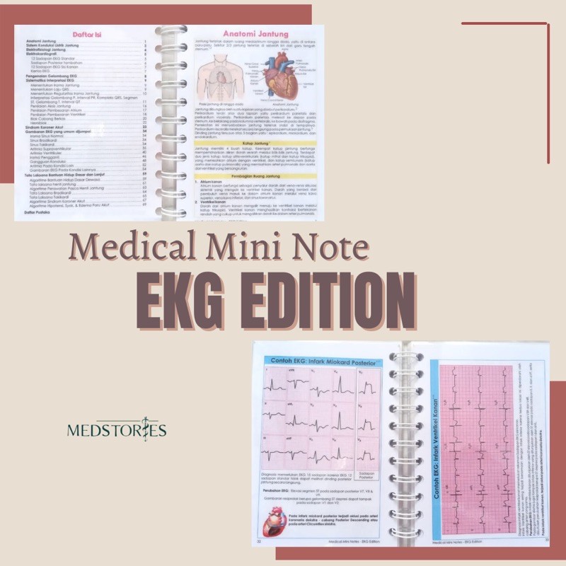 Jual MMN EKG | ECG NOTES | MEDICAL MINI NOTES | MEDSTORIES | Shopee ...