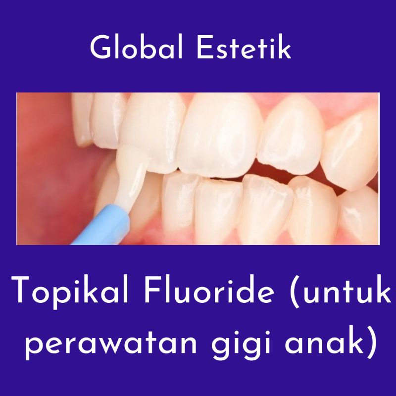 Jual Topikal Fluoride (untuk perawatan gigi anak) Shopee Indonesia