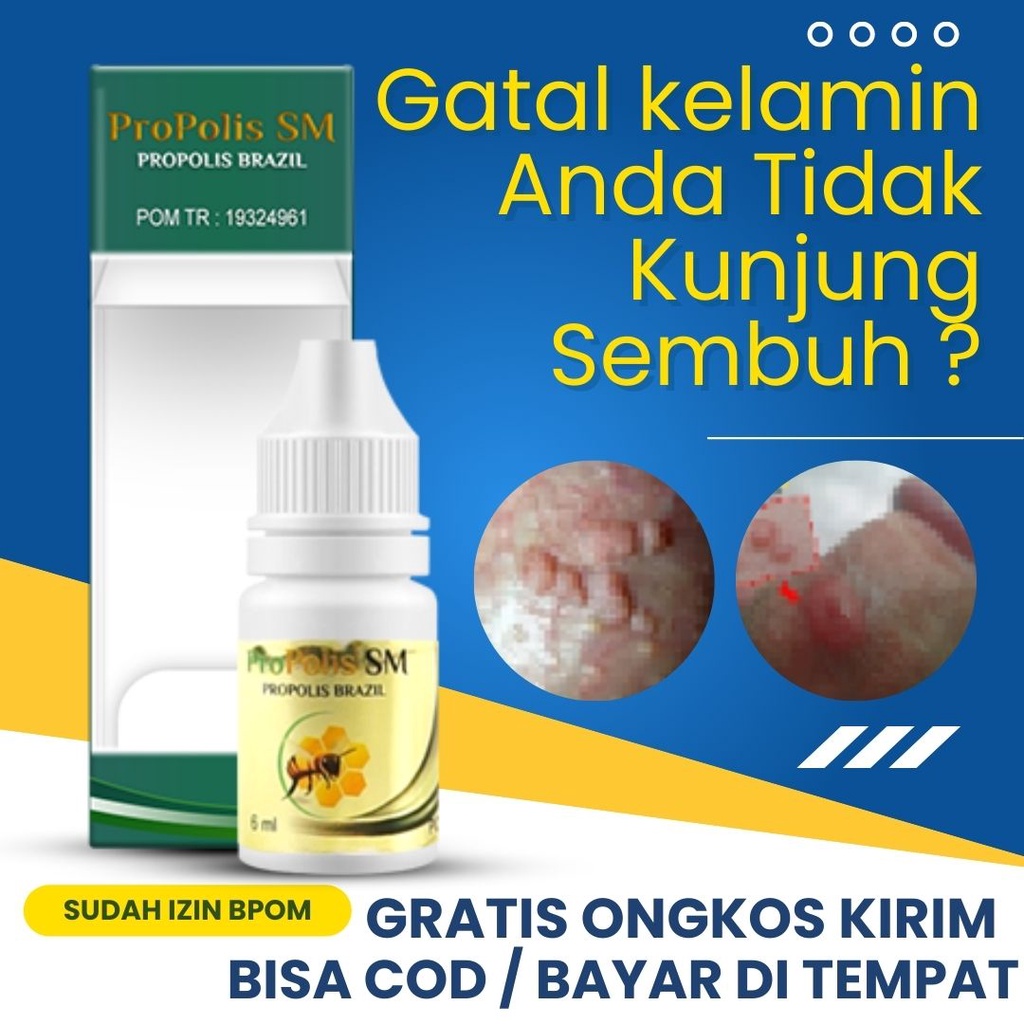 Jual Propolis Sm Obat Gatal Kelamin Obat Gatal Di Buah Zakar 100 Alami Tanpa Efek Samping 2251