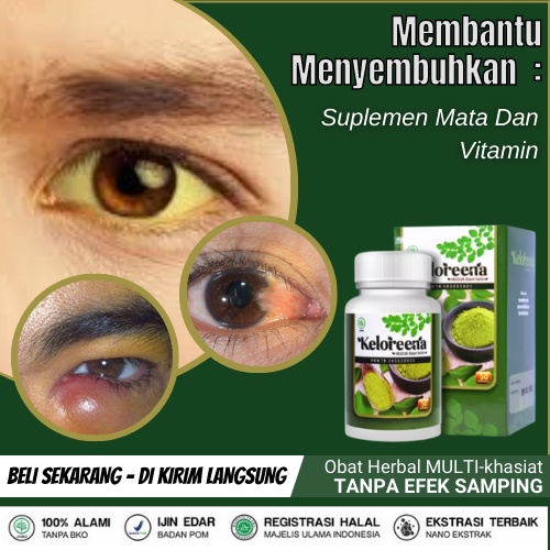 Jual Suplemen Mata Dan Vitamin Penjernih Mata Kuning, Merah, Mata Buram ...