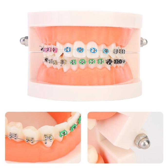 Jual Model Gigi Orthodontic Behel Metal Bracket Phantom Ortho Studi Model Original Shopee