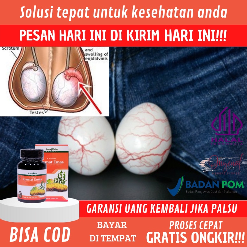 Jual Obat Buah Zakar Bengkak Sebelah Obat Varises Buah Zakar Penumpukan Cairan Di Testis Obat