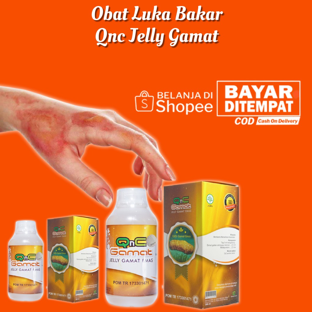 Jual Obat Luka Bakar Tersiram Air Panas Luka Melepuh Tersiram Air