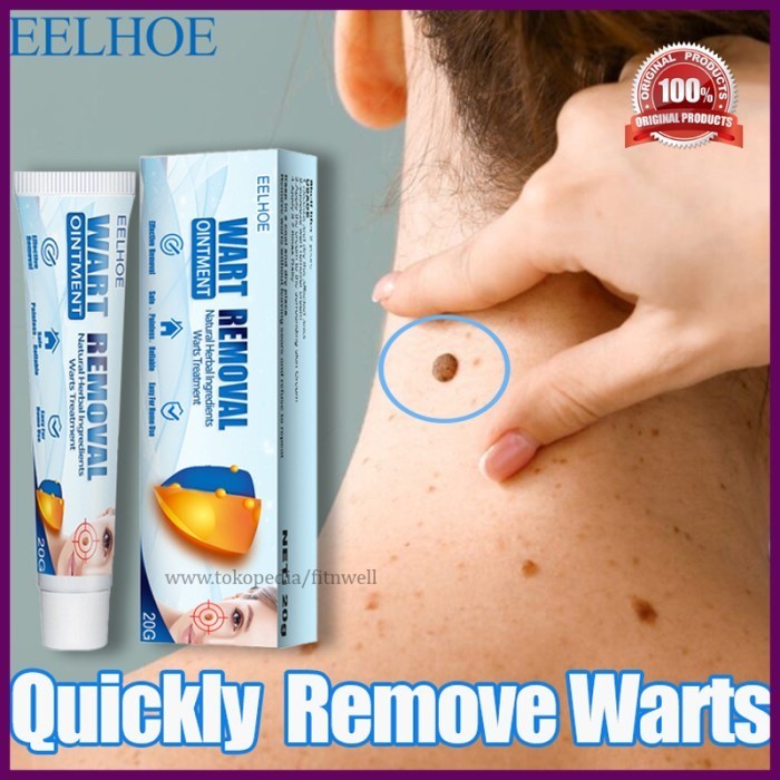 Jual 【eelhoe】warts Remover Original Cream Skin Tag Remover Shopee Indonesia 3564