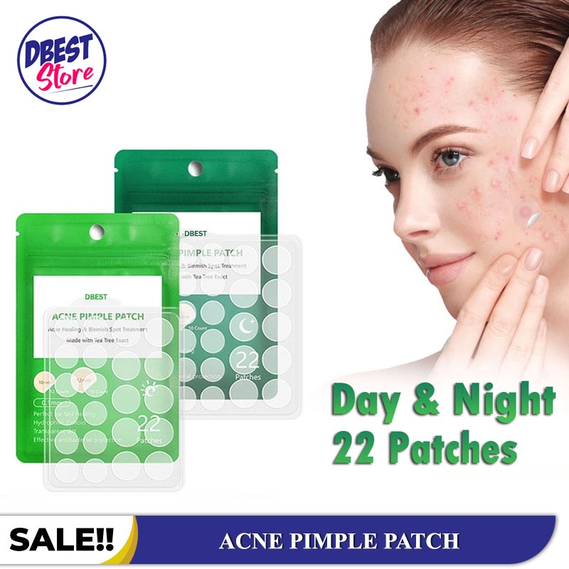Jual 1 Patch Isi 22PCS!! Obat Jerawat Paling Ampuh - Acne Pimple Patch ...