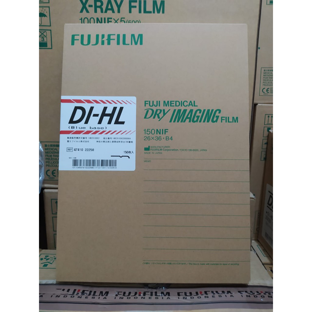 Jual FILM RONSEN CR DIHL FILM RONTGEN DIHL UKURAN 26 X 36 CM RADIOLOGI ...
