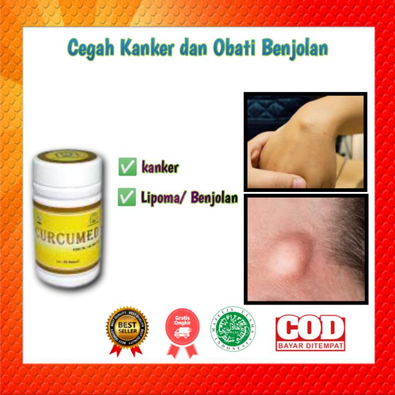 Jual Obat Benjolan Obat Lipoma Obat Tumor CURCUMED | Shopee Indonesia