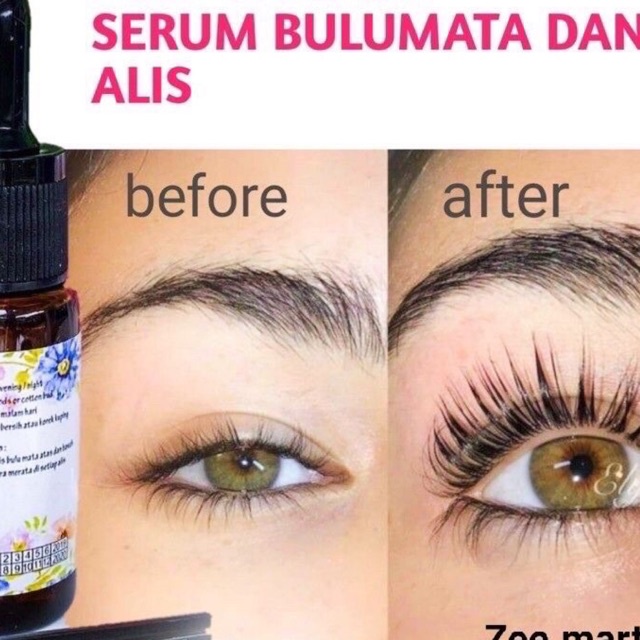 Jual Oilash Serum Penumbuh Bulu Mata Dan Alis Oil Lash Aylash Serum