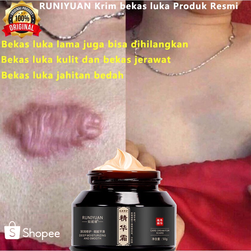 Jual Zhenxiu Krim Bekas Luka Produk Resmi Penghilang Bekas Luka Ekstrak