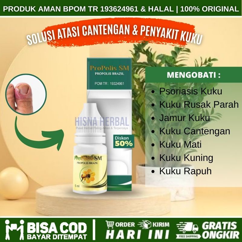 Jual Obat Cantengan Sakit Kuku Jari Jempol Kaki Tangan Bengkak Canteng