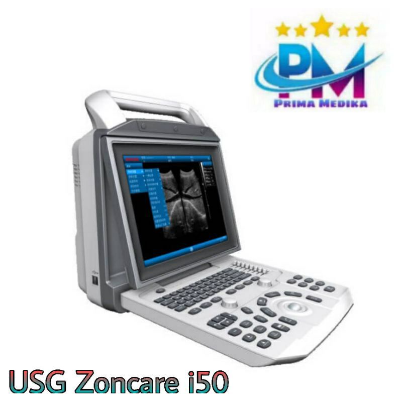 Jual USG 2D Zoncare i50 / 2 Dimensi USG Zoncare (Pulse Wave Doppler ...