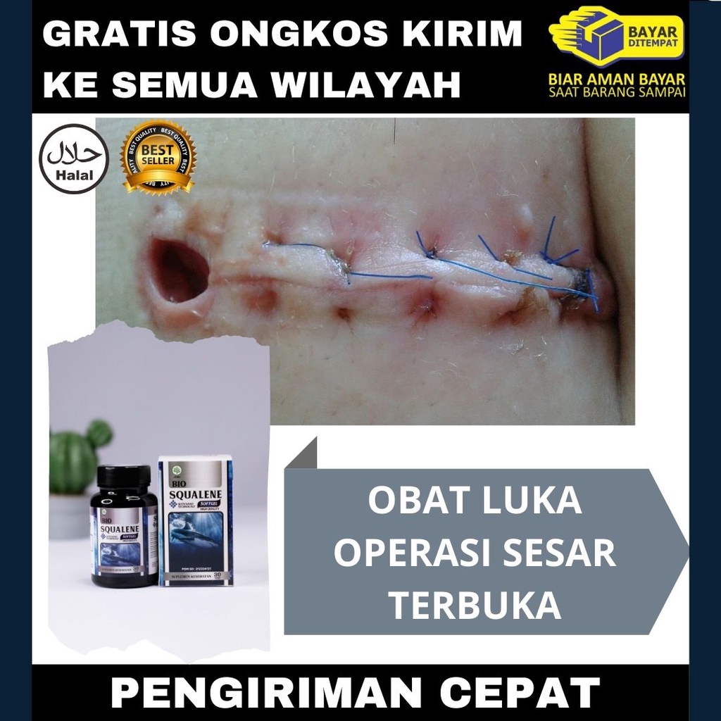 Jual Obat luka operasi sesar terbuka, Jahitan operasi terbuka, Luka