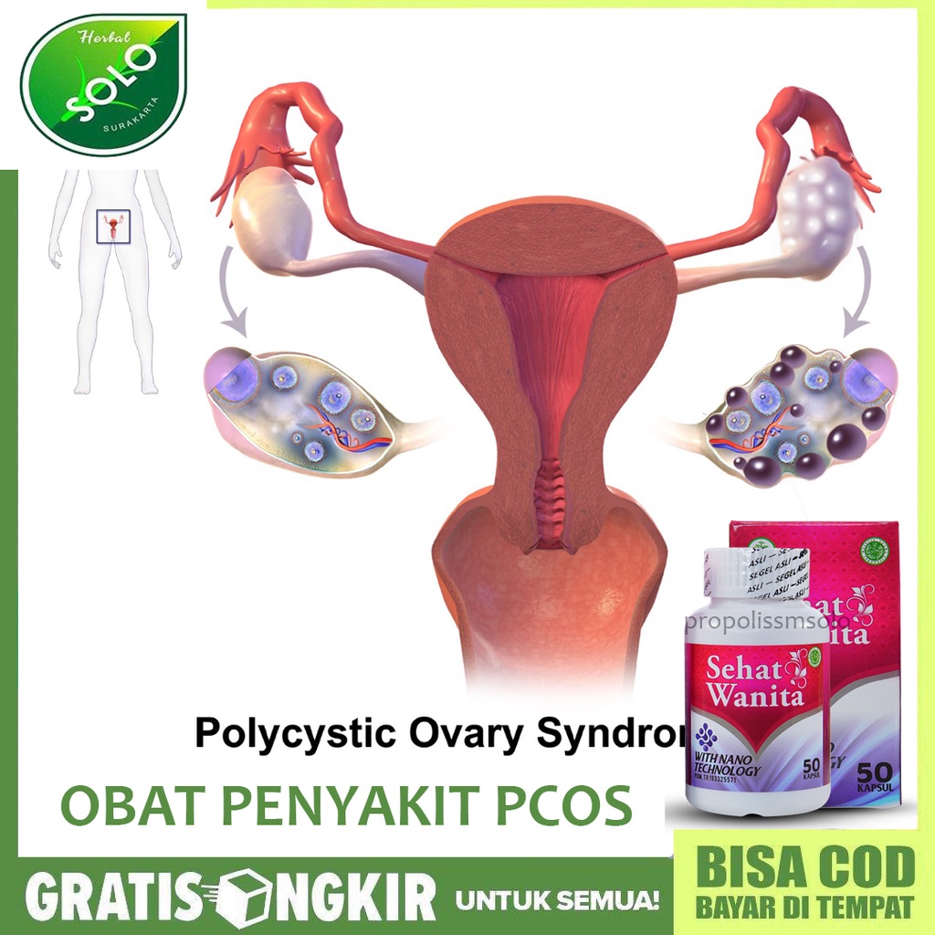 Jual Obat Sindrom Polikistik Ovarium PCOS Gangguan Hormon pada Wanita ...
