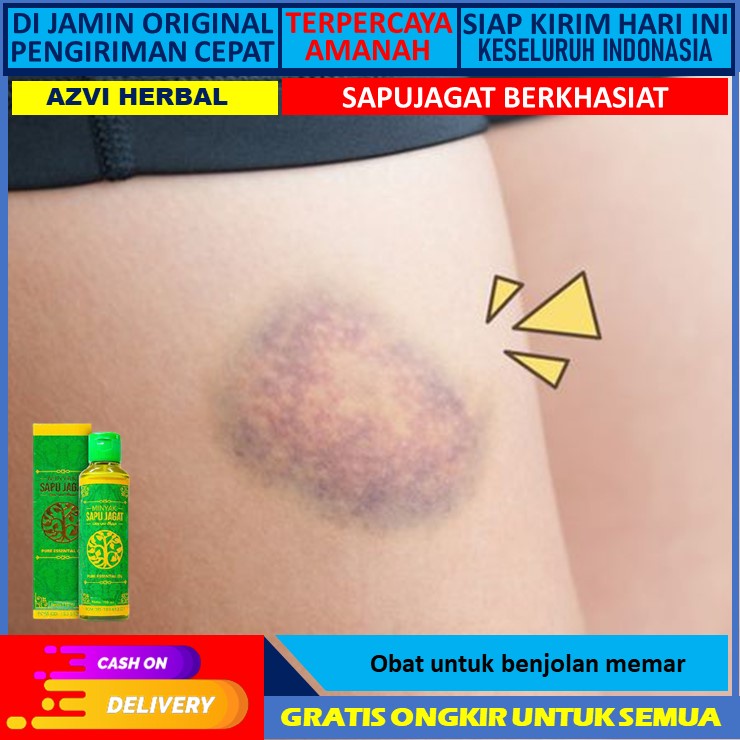 Jual Obat Benjolan Memar Minyak Urut Patah Tulang Keseleo Memar Obat Bengkak Obat Oles