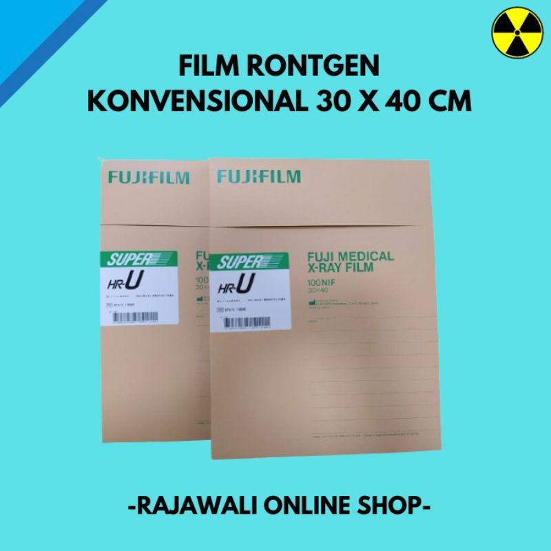 Jual Film Rontgen#Filmronsen #Filmrontgen #Ronsen #Rontgen # ...