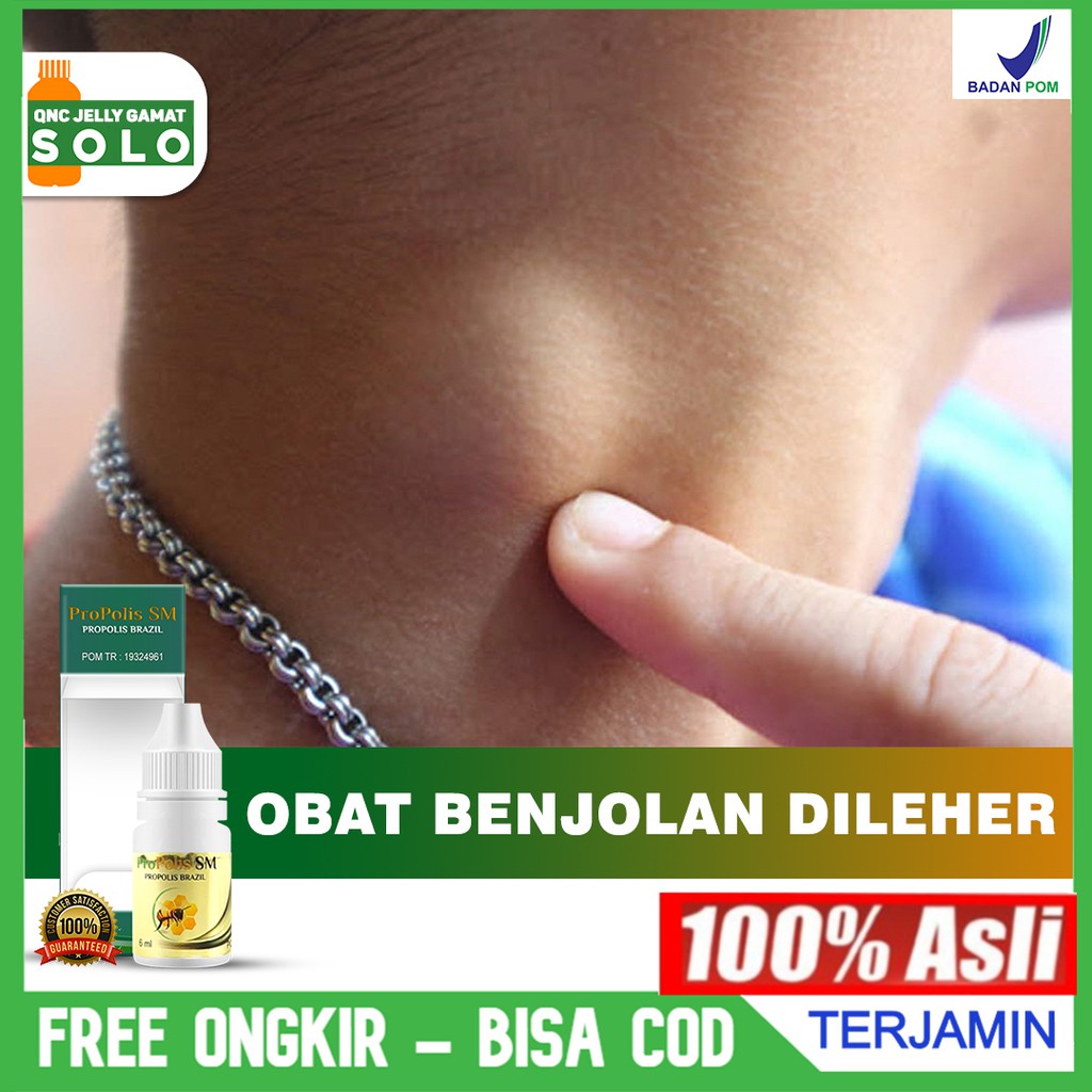 Jual Obat Benjolan Di Leher Kiri Kanan, Kelenjar Tiroid, Kelenjar Getah