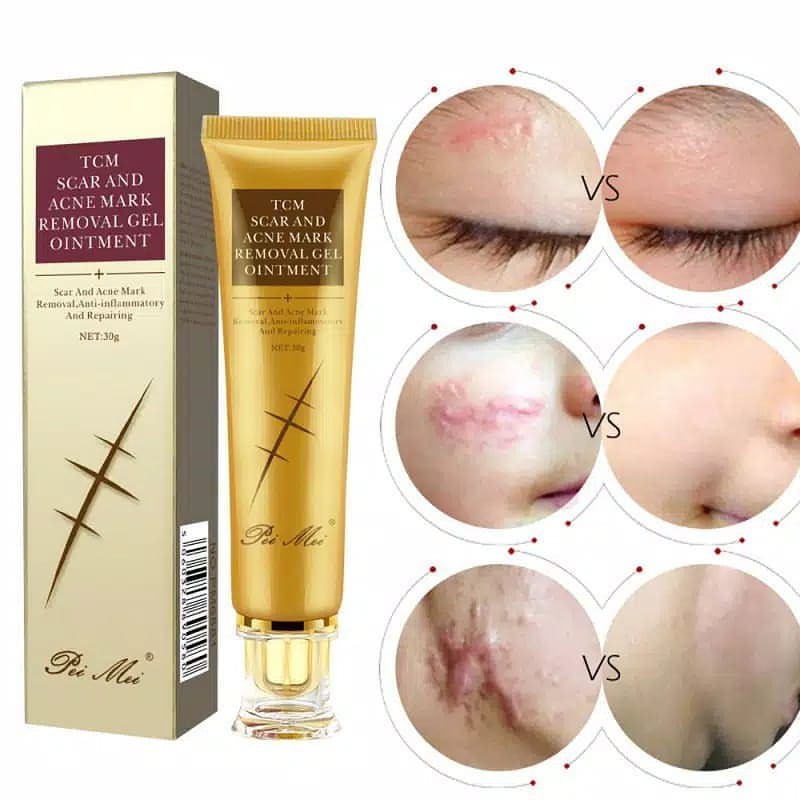 Jual TCM Scar & Acne Mark Removal Gel Ointment / Cream Bekas Luka ...