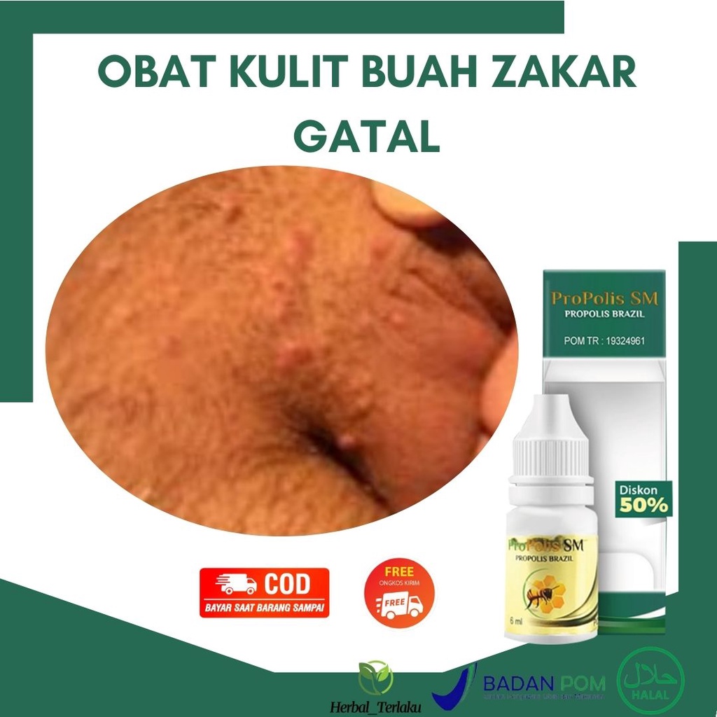 Jual Obat Kulit Buah Zakar Gatal Gatal Mengelupas Melepuh Lecet