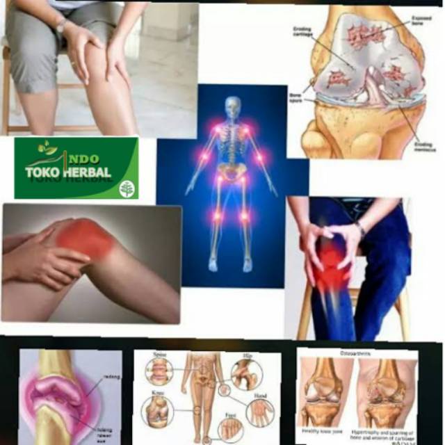Jual Flex Active Flexactive Obat Persendian Tulang Atasi Nyeri Sendi ...