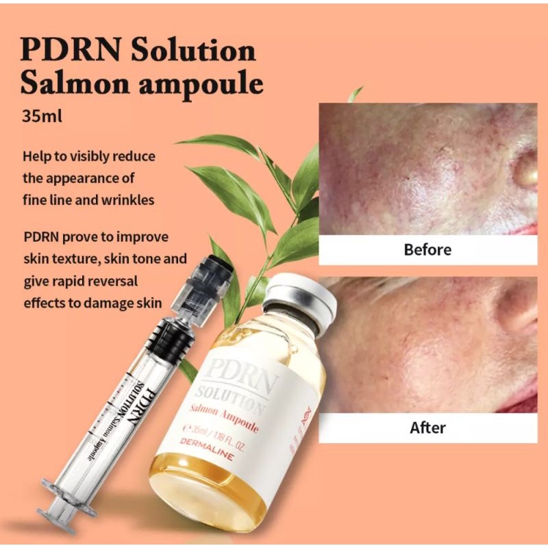Jual PDRN Solution Salmon Ampoule | Shopee Indonesia