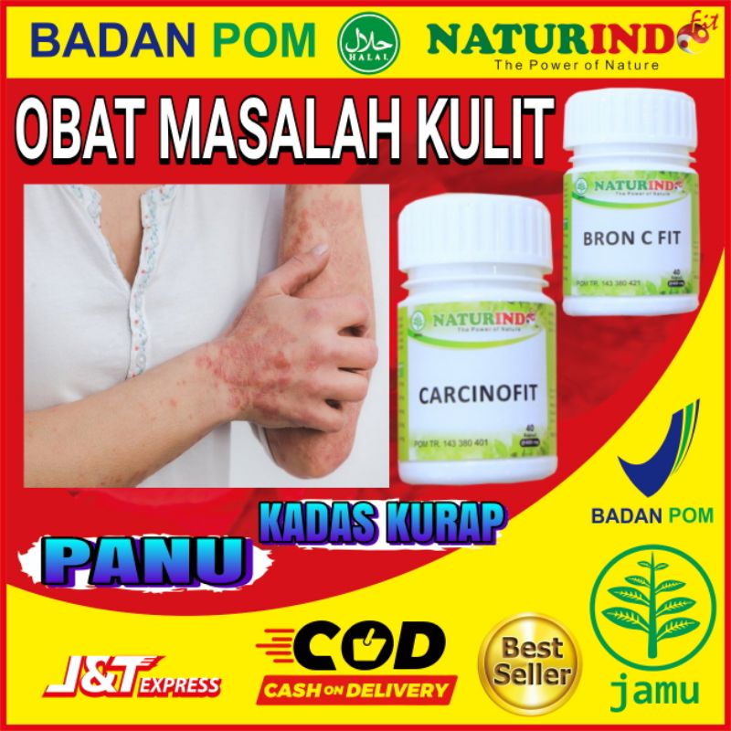 Jual Obat Panu Kadas Kurap Kudis Herbal Ampuh Obat Gudik Gudikan Gatal ...