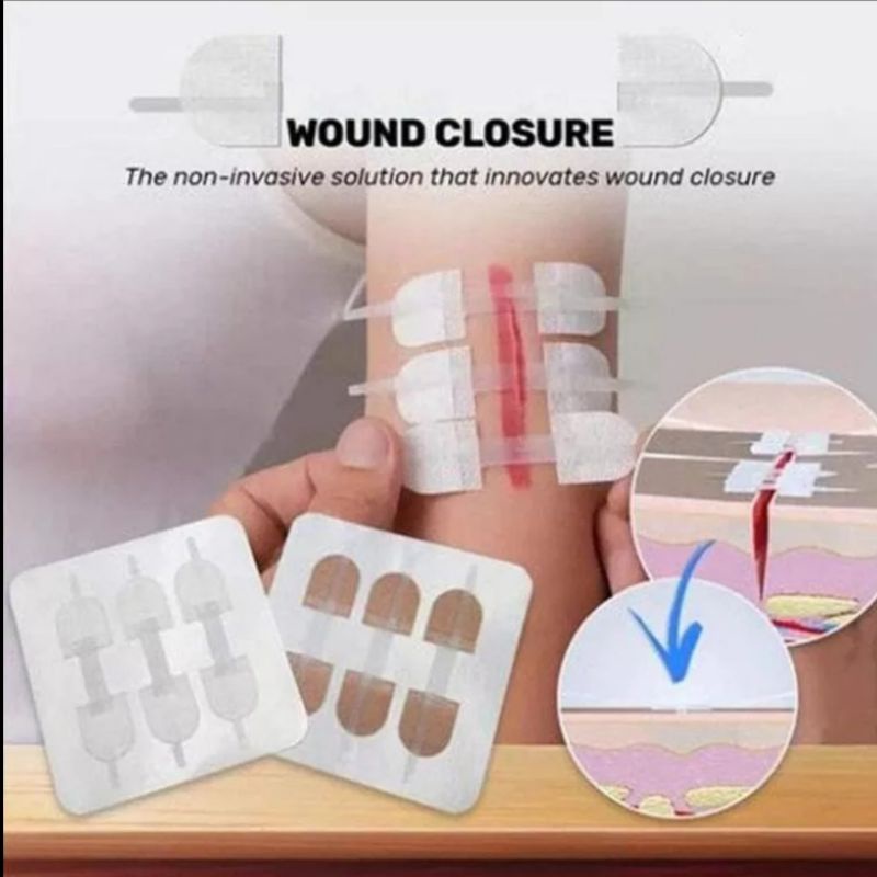 Jual penutup luka tanpa jahit (wound closure) Shopee Indonesia