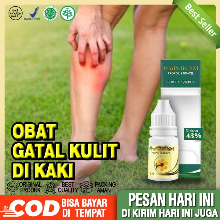 Jual Obat Gatal Kulit Di Kaki, Gatal Kulit Berair, Gatal Bintik Berair ...