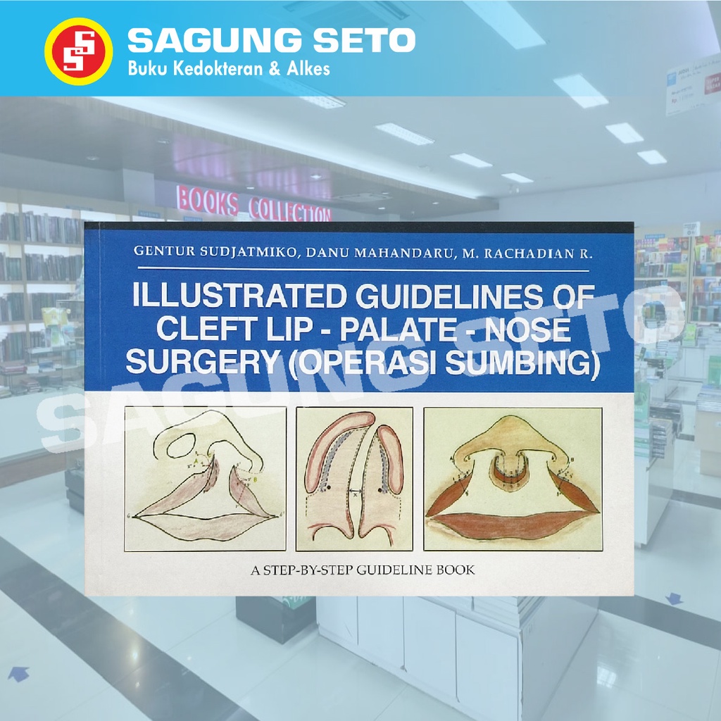 Jual ILLUSTRATED GUIDELINES OF CLEFT LIP PALATE NOSE SURGERY - GENTUR ...