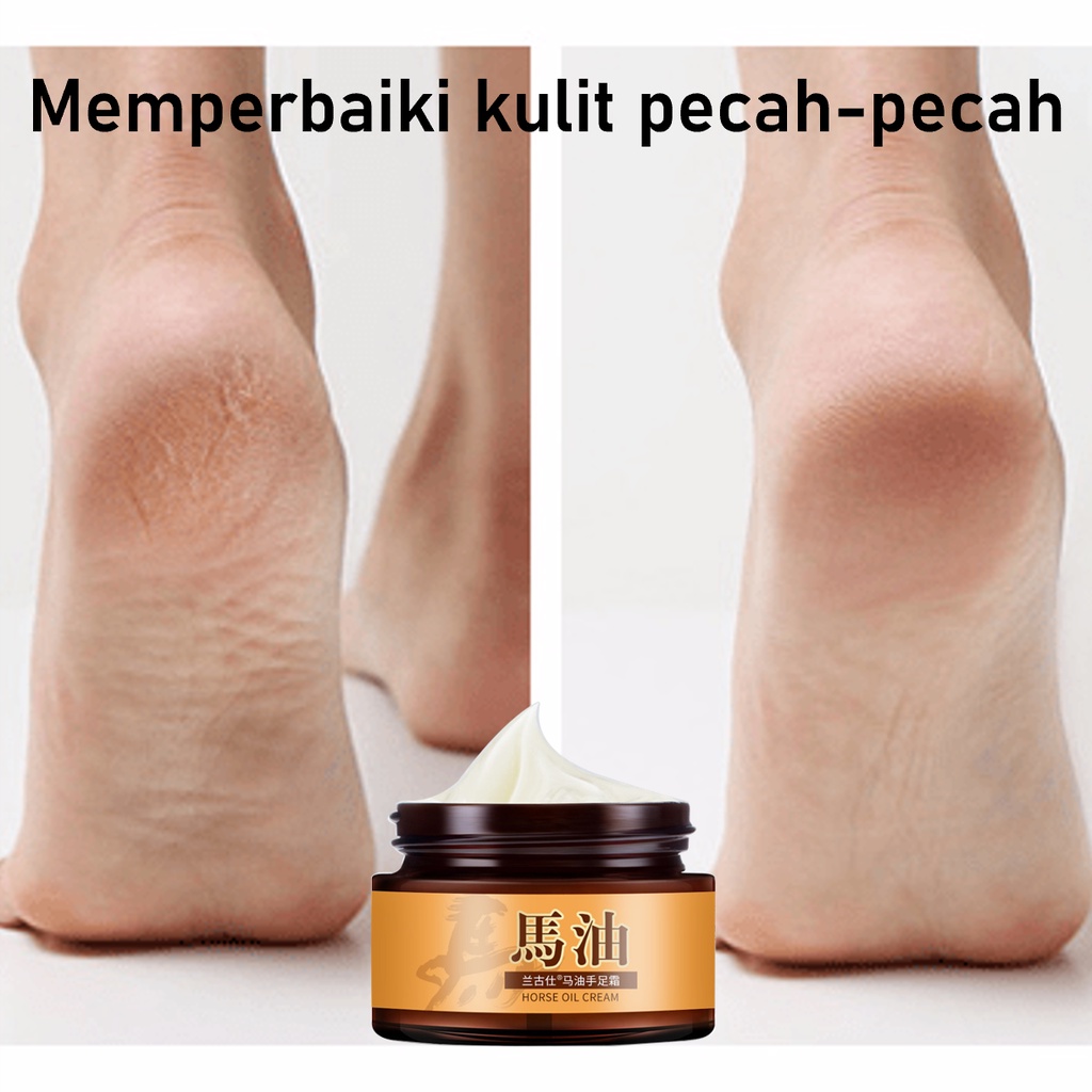 Jual Obat Kaki Pecah Dan Kering Tumitku Obat Kaki Pecah G Penghalus Tumit Kaki Original