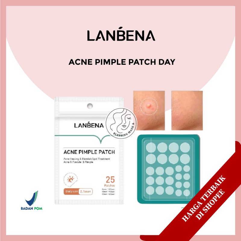 Jual Lanbena Acne Pimple Patch Day Stiker Night Sticker Shopee Indonesia