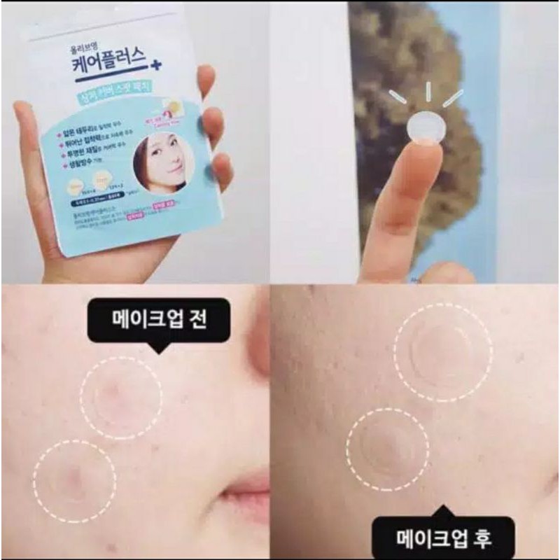 Jual Olive Young Pimple Patch (exp 2023 feb) Shopee Indonesia