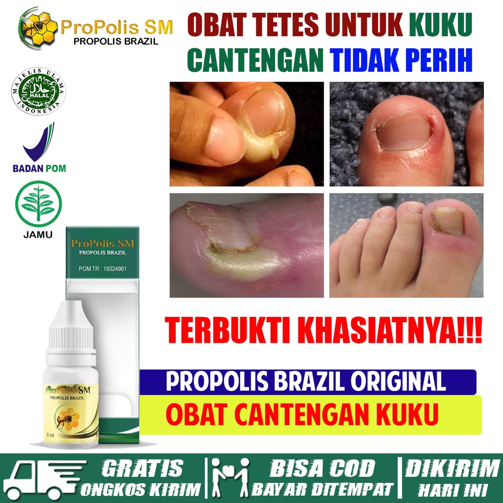 Jual Obat Cantengan Obat Tetes Cantengan Cantengan Jempol Kaki