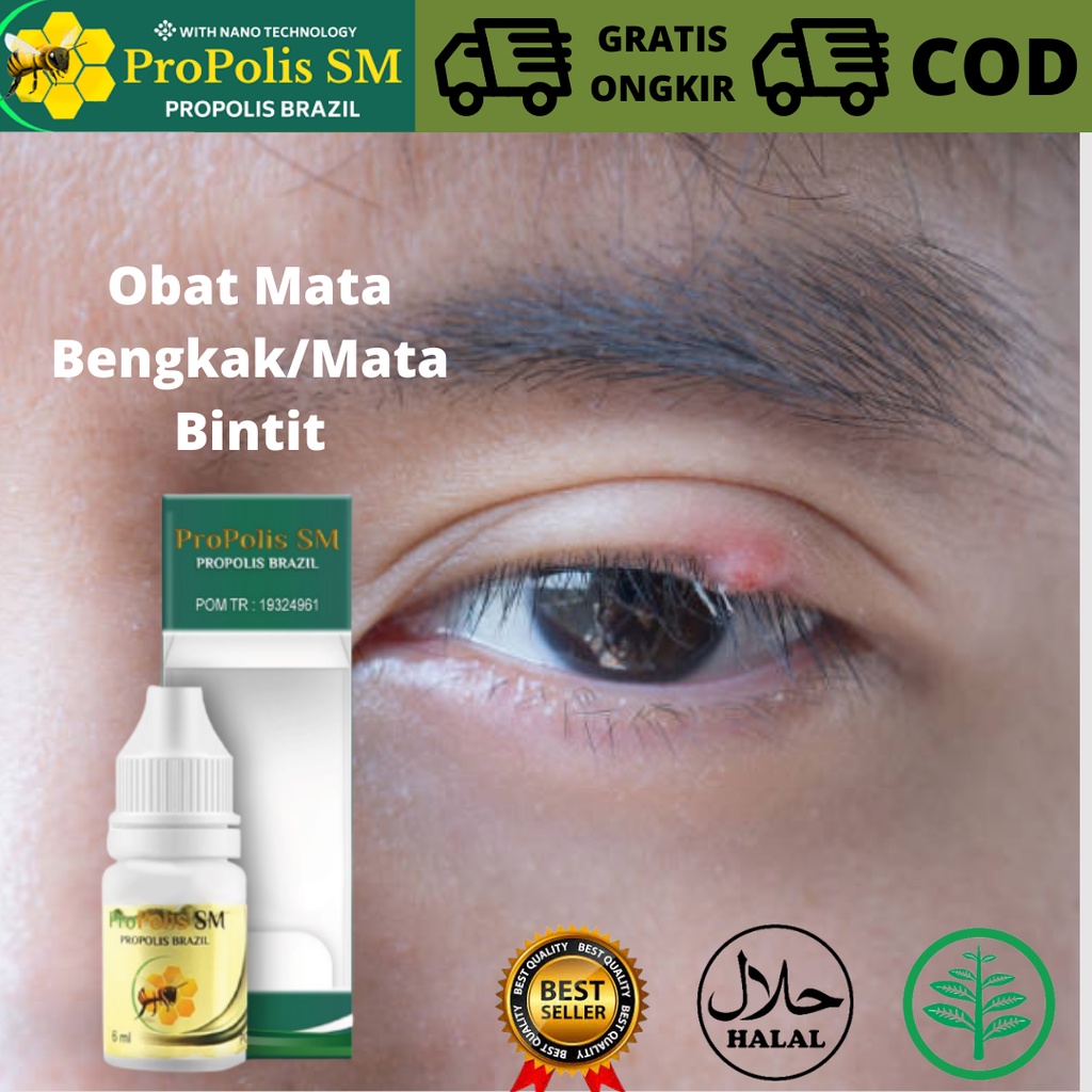 Jual Obat Mata Bintitan, OBAT UNTUK MATA BINTITAN PADA ANAK & DEWASA ...