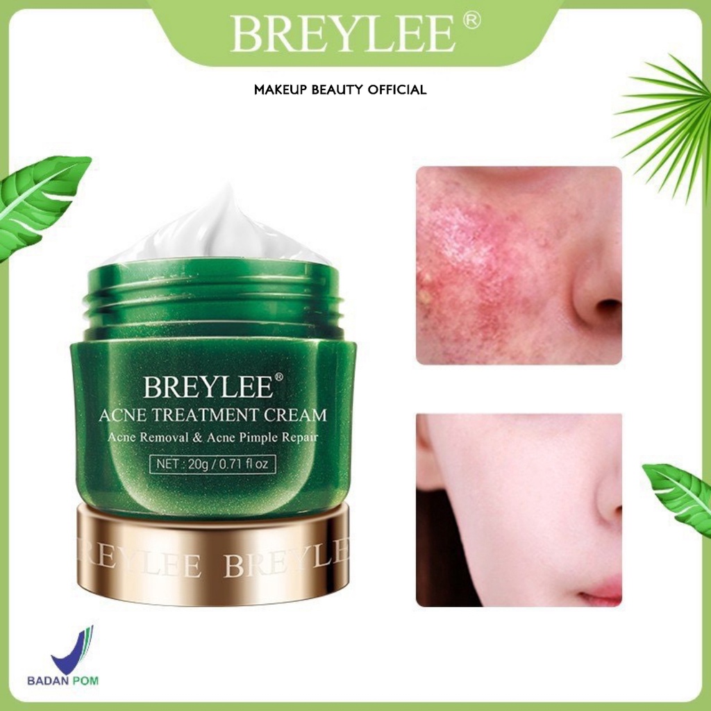 Jual [BPOM] BREYLEE Acne Treatment Cream 20g | Shopee Indonesia