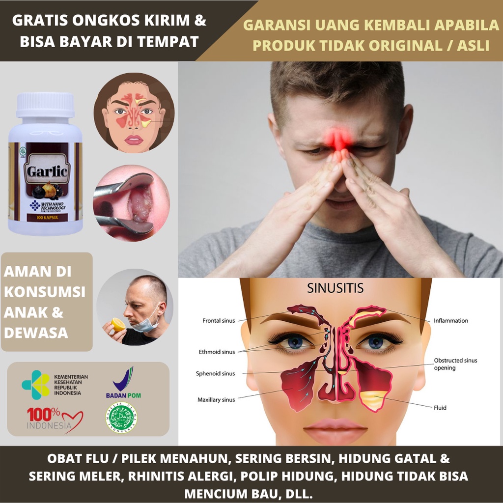 Jual Obat Flu / Pilek Menahun, Obat Sering Bersin, Obat Rhinitis Hidung ...