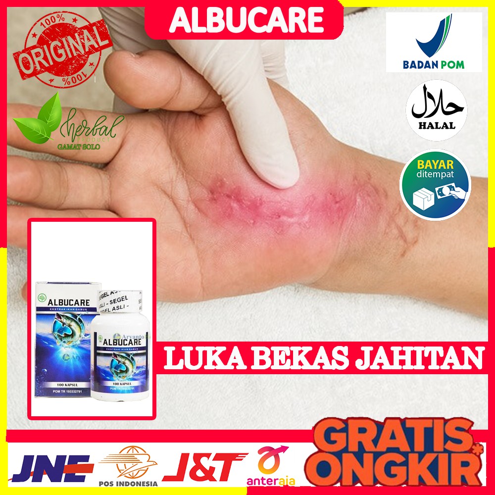 Jual Mengobati Bekas Jahitan, Menghilangkan Luka Bekas Jahitan, Luka