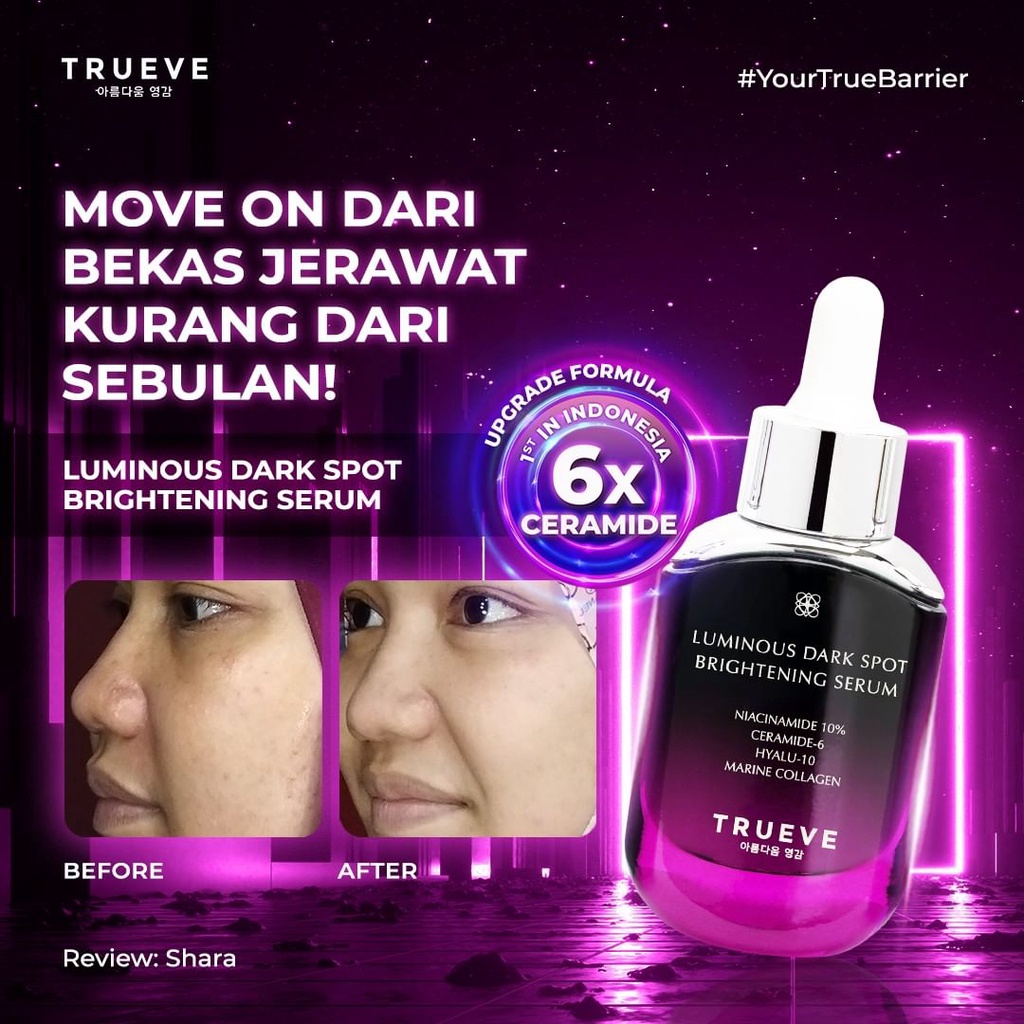 Jual Truve NIACINAMIDE 10% Brightening Serum Penghilang Flek Hitam dan ...