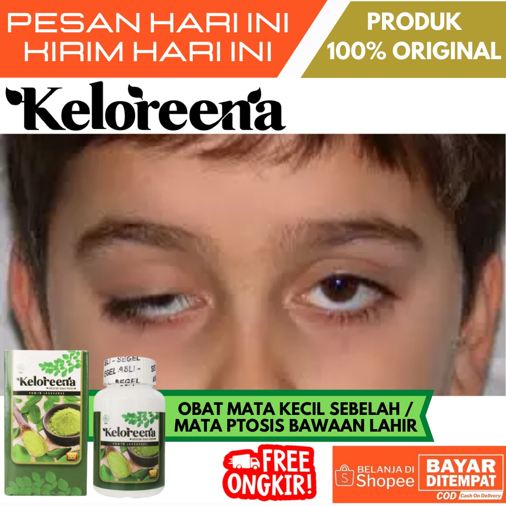 Jual Obat Saraf Mata Lemah Rusak Myasthenia Gravis Miastenia