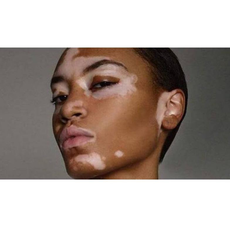 Jual MUSTARD OIL MINYAK BIJI SAWI 100 ML PENUMBUH RAMBUT & OBAT