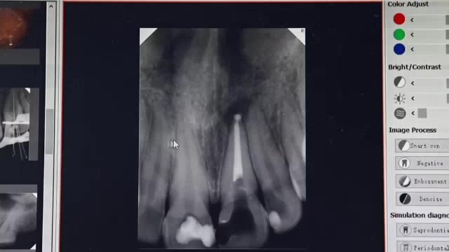 Jual Dental X-Ray (rontgen) Portable+sensor | Shopee Indonesia
