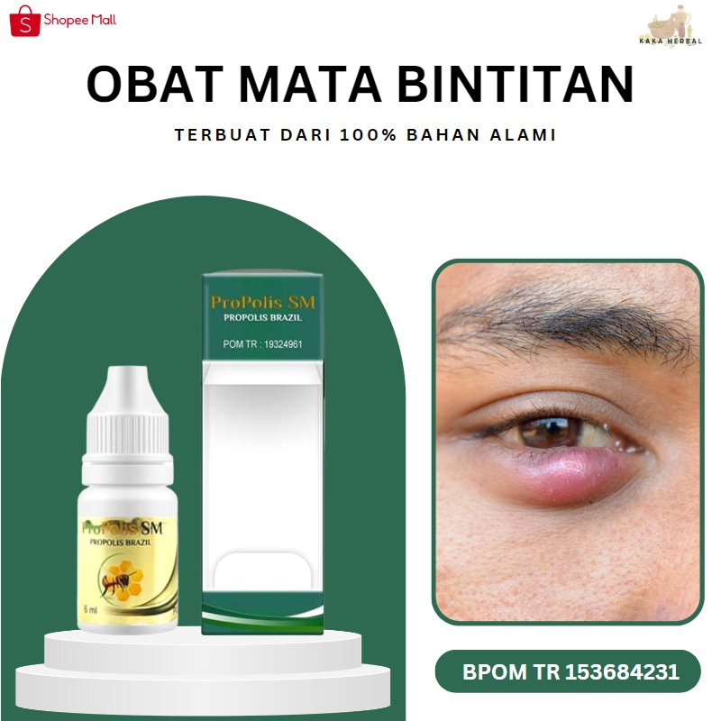 Jual Kaka Herbal Obat Mata Bintitan Salep Mata Bintitan Obat Mata