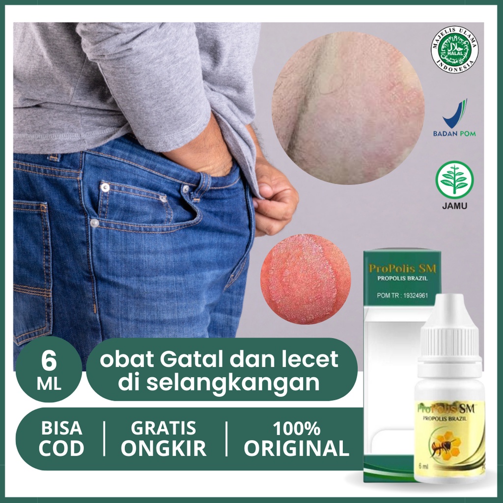 Jual Obat Gatal dan Lecet Selangkangan, Miss V Gatal dan Perih, Gatal