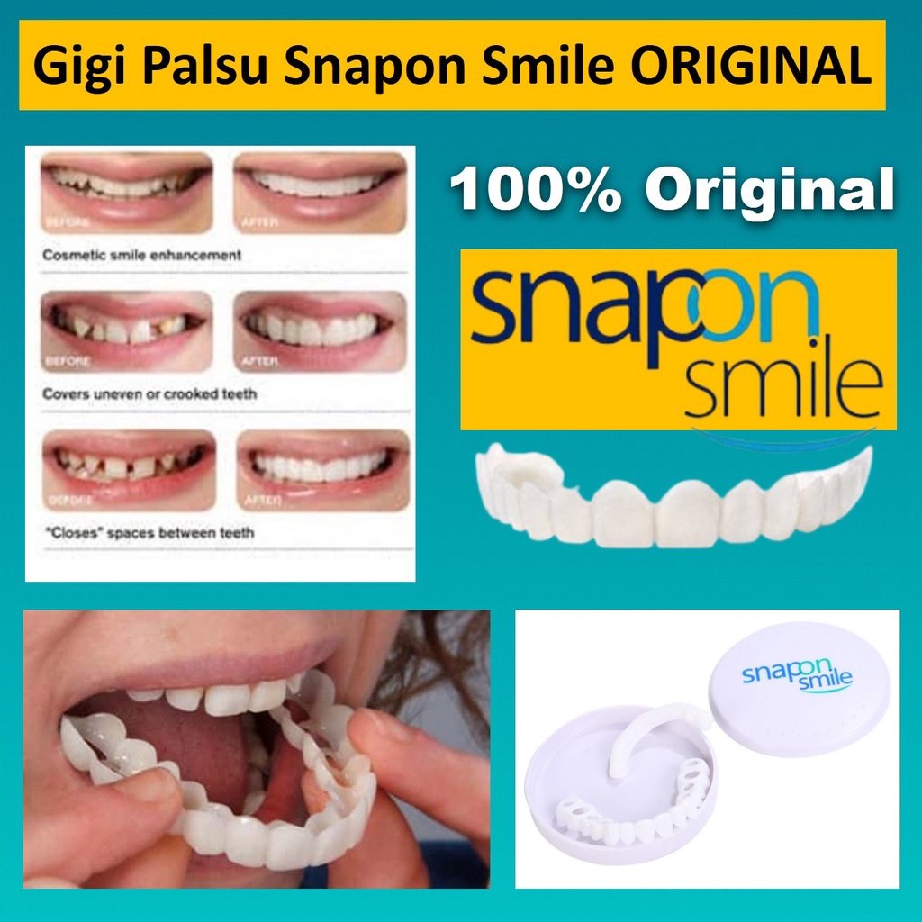 Jual Gigi Palsu Instan 1 Set Atas Bawah Snap On Smile 100% Original ...